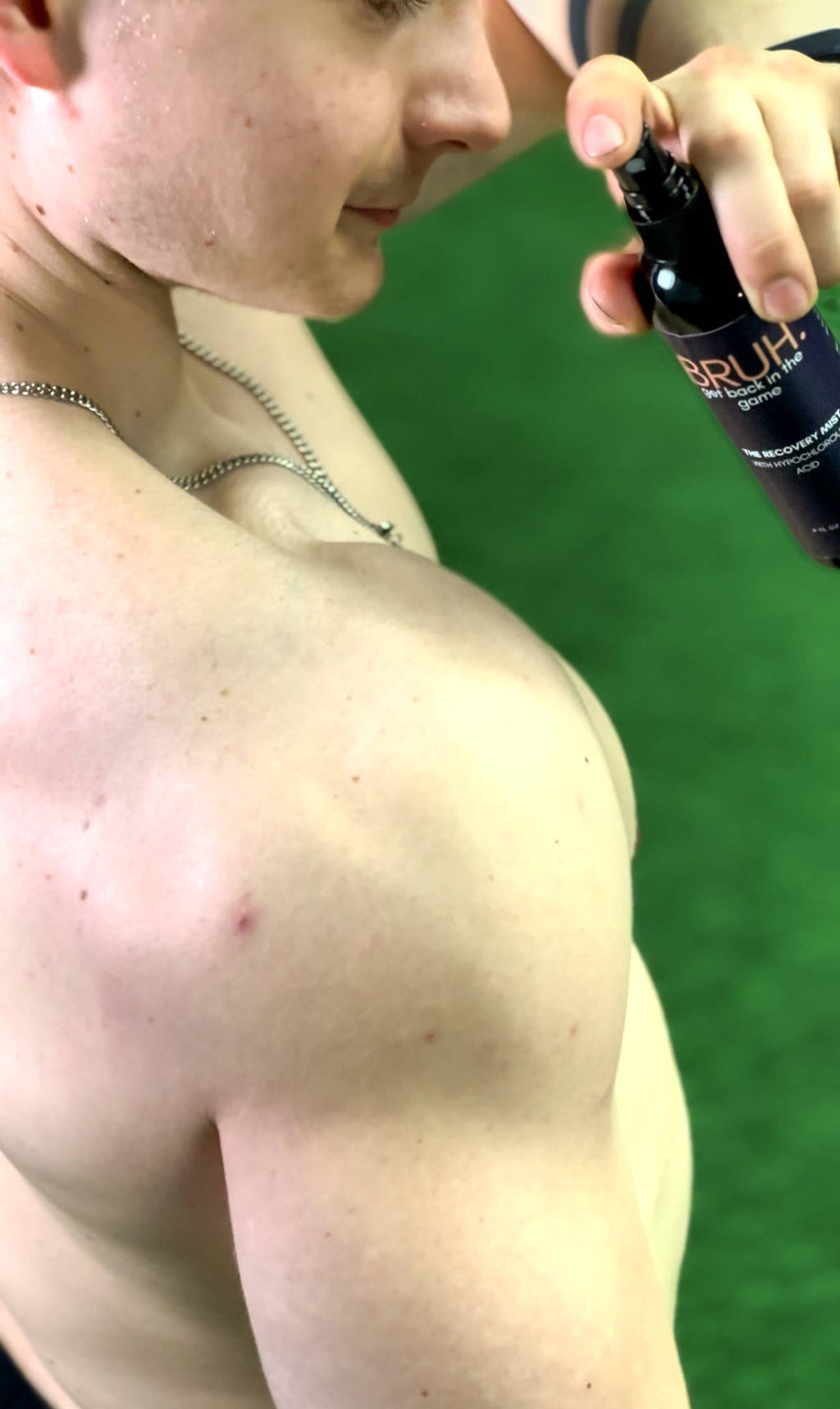 BRUH. THE RECOVERY MIST with Hypochlorous Acid